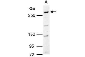 WB Image CAD antibody [C2C3], C-term detects CAD protein by Western blot analysis. (CAD 抗体  (C-Term))