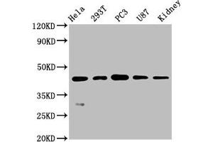 Western Blot Positive WB detected in: Hela whole cell lysate, 293T whole cell lysate, PC3 whole cell lysate, U87 whole cell lysate, Mouse kidney tissue All lanes: NDRG1 antibody at 0. (Recombinant NDRG1 抗体)