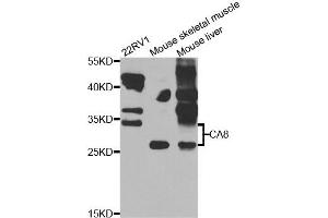 Western blot analysis of extracts of various cell lines, using CA8 antibody.