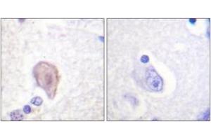 Immunohistochemistry analysis of paraffin-embedded human brain tissue, using C-RAF (Ab-43) Antibody.
