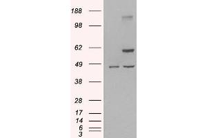 Western Blotting (WB) image for anti-TNF Receptor-Associated Factor 2 (TRAF2) (C-Term) antibody (ABIN190911)