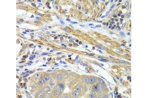 Immunohistochemistry (Paraffin-embedded Sections) (IHC (p)) image for anti-Protein Interacting With Protein Kinase C, alpha 1 (PICK1) antibody (ABIN7257176)