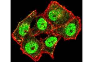 Immunofluorescence analysis of Hela cells using TDP43 mouse mAb (green). (TARDBP 抗体)