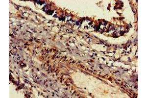 Immunohistochemistry of paraffin-embedded human lung tissue using ABIN7150873 at dilution of 1:100 (Dnah5 抗体  (AA 2364-2560))