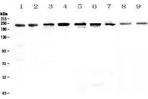 Western blot analysis of BRG1 using anti-BRG1 antibody . (SMARCA4 抗体  (AA 555-763))