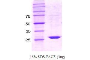 SDS-PAGE (SDS) image for Protein-tyrosine Phosphatase 1C (PTPN6) protein (ABIN666674) (SHP1 蛋白)