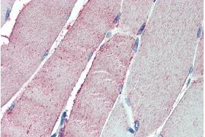 ABIN185115 (5µg/ml) staining of paraffin embedded Human Skeletal Muscle. (OSBPL1A 抗体  (C-Term))