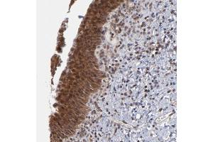 Immunohistochemical staining of human urinary bladder with UBE2L6 polyclonal antibody  shows strong cytoplasmic and nuclear positivity in urothelial cells at 1:50-1:200 dilution. (UBE2L6 抗体)