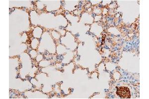 ABIN6267576 at 1/200 staining Mouse lung tissue sections by IHC-P. (Smad2/3 抗体  (pThr8, Thr8))