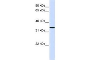 Image no. 1 for anti-Chromosome 16 Open Reading Frame 78 (C16orf78) (AA 108-157) antibody (ABIN6741159) (C16orf78 抗体  (AA 108-157))