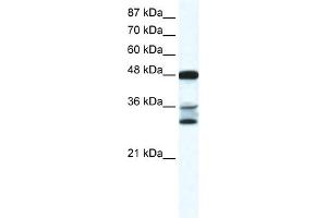 WB Suggested Anti-TNFSF10 Antibody Titration:  0.