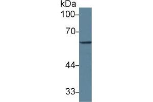 Detection of GAD1 in Mouse Cerebrum lysate using Polyclonal Antibody to Glutamate Decarboxylase 1, Brain (GAD1) (GAD 抗体  (AA 1-97))