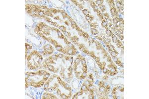 Immunohistochemistry of paraffin-embedded mouse kidney using  antibody (ABIN6131166, ABIN6136417, ABIN6136418 and ABIN6223845) at dilution of 1:100 (40x lens). (ACAT2 抗体  (AA 1-97))