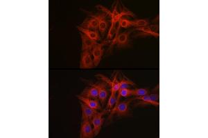 Immunofluorescence analysis of C6 cells using β-Tubulin Rabbit pAb (ABIN3020552, ABIN3020553 and ABIN3020554) at dilution of 1:100 (40x lens). (TUBB 抗体  (AA 40-260))