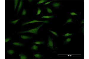 Immunofluorescence of purified MaxPab antibody to PIN4 on HeLa cell. (PIN4 抗体  (AA 1-156))