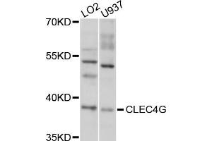 Western blot analysis of extracts of LO2 and U937 cells, using CLEC4G antibody. (CLEC4G 抗体)