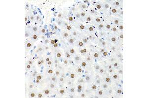 Immunohistochemistry of paraffin-embedded rat liver using PTBP1 antibody. (PTBP1 抗体  (AA 1-100))