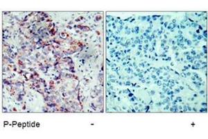 Image no. 1 for anti-Mitogen-Activated Protein Kinase Kinase 4 (MAP2K4) (pSer80) antibody (ABIN196910) (MAP2K4 抗体  (pSer80))