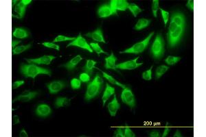 Immunofluorescence (IF) image for anti-Kinesin Family Member C1 (KIFC1) (AA 53-152) antibody (ABIN561612)