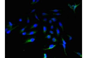 Immunofluorescent analysis of Hela cells using ABIN7143952 at dilution of 1:100 and Alexa Fluor 488-congugated AffiniPure Goat Anti-Rabbit IgG(H+L) (ABHD14A 抗体  (AA 56-258))
