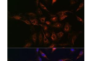 Immunofluorescence analysis of C6 cells using ABCA1 Polyclonal Antibody at dilution of 1:100 (40x lens). (ABCA1 抗体)