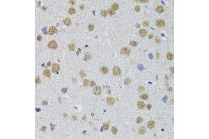 Immunohistochemistry (Paraffin-embedded Sections) (IHC (p)) image for anti-DNA Methyltransferase 1-Associated Protein 1 (DMAP1) (AA 1-305) antibody (ABIN6139677)