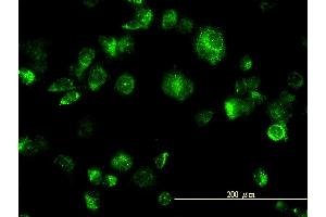 Immunofluorescence of monoclonal antibody to MAPK12 on HeLa cell. (MAPK12 抗体  (AA 251-367))