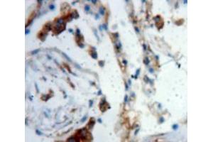 Used in DAB staining on fromalin fixed paraffin-embedded Lung tissue (LTBP2 抗体  (AA 522-814))