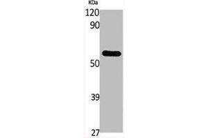 Western Blot analysis of various cells using GCK Polyclonal Antibody (GCK 抗体  (N-Term))