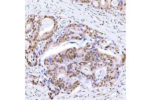 IHC analysis of Symplekin/SYMPK using anti-Symplekin/SYMPK antibody (ABIN7601558).