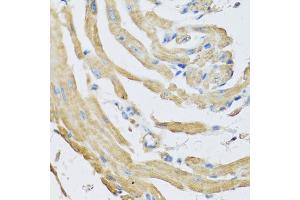 Immunohistochemistry of paraffin-embedded mouse heart using SFRP4 antibody (ABIN5973810) at dilution of 1/100 (40x lens). (SFRP4 抗体)