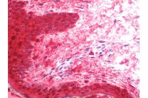 Anti-LGALS7 / Galectin 7 antibody IHC staining of human skin. (LGALS7 抗体  (Biotin))