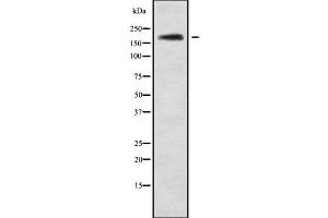 Western blot analysis NRXN3 using Jurkat whole cell lysates (Neurexin 3 抗体  (Internal Region))