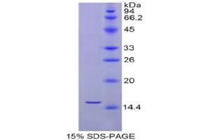 SDS-PAGE analysis of Human Selenoprotein X1 Protein. (MSRB1 蛋白)