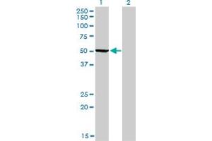 Western Blot analysis of PHGDH expression in transfected 293T cell line by PHGDH monoclonal antibody (M01), clone 4A3-1D6. (PHGDH 抗体  (AA 1-533))