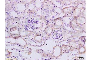 Formalin-fixed and paraffin embedded mouse colon tissue labeled with Anti-TNFSF18 Polyclonal Antibody, Unconjugated (ABIN740535) at 1:200 followed by conjugation to the secondary antibody and DAB staining (TNFSF18 抗体  (AA 101-199))
