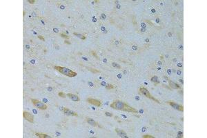 Immunohistochemistry of paraffin-embedded Rat brain using SARS Polyclonal Antibody at dilution of 1:100 (40x lens). (Seryl-tRNA Synthetase (SARS) 抗体)