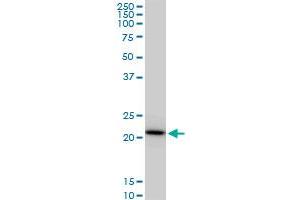 RPS5 monoclonal antibody (M02), clone 4H3.