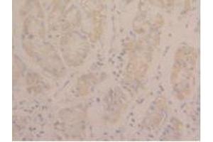 Immunohistochemistry (IHC) image for anti-Signal Transducer and Activator of Transcription 3 (Acute-Phase Response Factor) (STAT3) (AA 335-546) antibody (ABIN7444046)