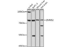 Western blot analysis of extracts of various cell lines, using ZNF652 antibody (ABIN7271517) at 1:1000 dilution. (ZNF652 抗体)