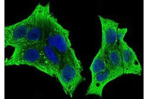 Fig. (CSF1R 抗体  (AA 344-497))