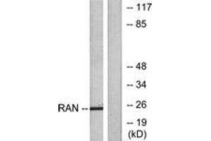 Western blot analysis of extracts from LOVO cells, using RAN Antibody. (RAN 抗体  (AA 167-216))