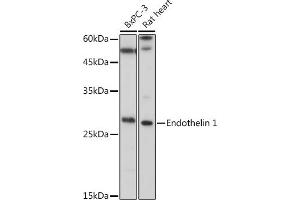 Western blot analysis of extracts of various cell lines, using Endothelin 1 antibody (ABIN3021075, ABIN3021076, ABIN3021077 and ABIN6213940) at 1:1000 dilution. (Endothelin 1 抗体  (AA 18-212))