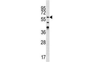 Western Blotting (WB) image for anti-Calcium/calmodulin-Dependent Protein Kinase II gamma (CAMK2G) (AA 309-338) antibody (ABIN3030258)