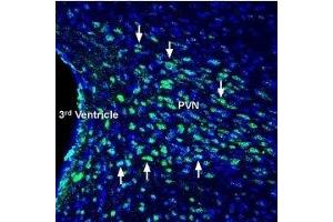 Expression of Glucagon receptor in mouse hypothalamus - Immunohistochemical staining of perfusion-fixed frozen mouse brain sections with Anti-Glucagon Receptor (extracellular) Antibody (ABIN7043218, ABIN7044410 and ABIN7044411), (1:200), followed by goat-anti-rabbit-AlexaFluor-488 secondary antibody. (Glucagon Receptor 抗体  (1st Extracellular Loop))