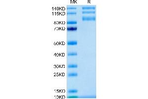 Biotinylated Human ITGAV&ITGB5 on Tris-Bis PAGE under reduced condition. (ITGAV/ITGB5 Protein (AA 31-992) (His-Avi Tag,Biotin))
