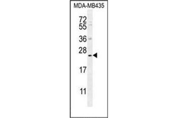 FAM109A 抗体  (N-Term)