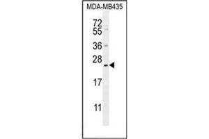 Western blot analysis of FAM109A Antibody (N-term) in MDA-MB435 cell line lysates (35ug/lane).