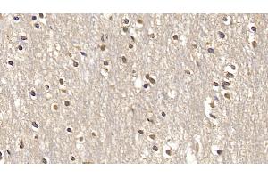 Detection of SMAD3 in Human Cerebrum Tissue using Monoclonal Antibody to SMAD family member 3 (SMAD3) (SMAD3 抗体  (AA 231-425))