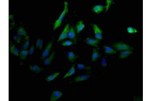 Immunofluorescence staining of Hela cells with ABIN7147154 at 1:100, counter-stained with DAPI.